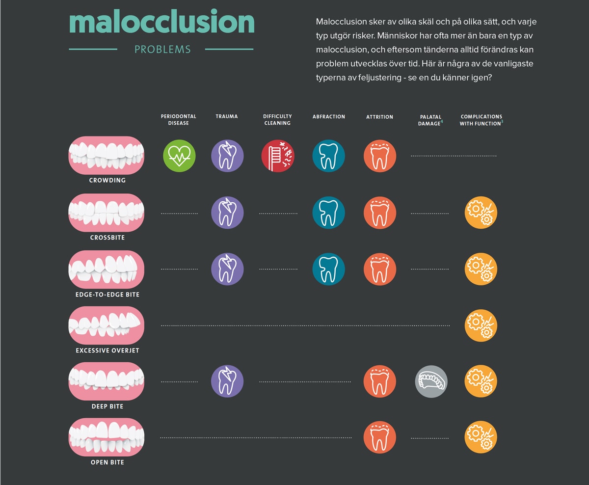 Infograf på olika formar av malocclusion